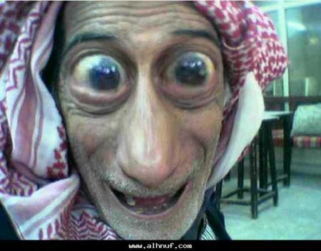 3winat kay ham9o